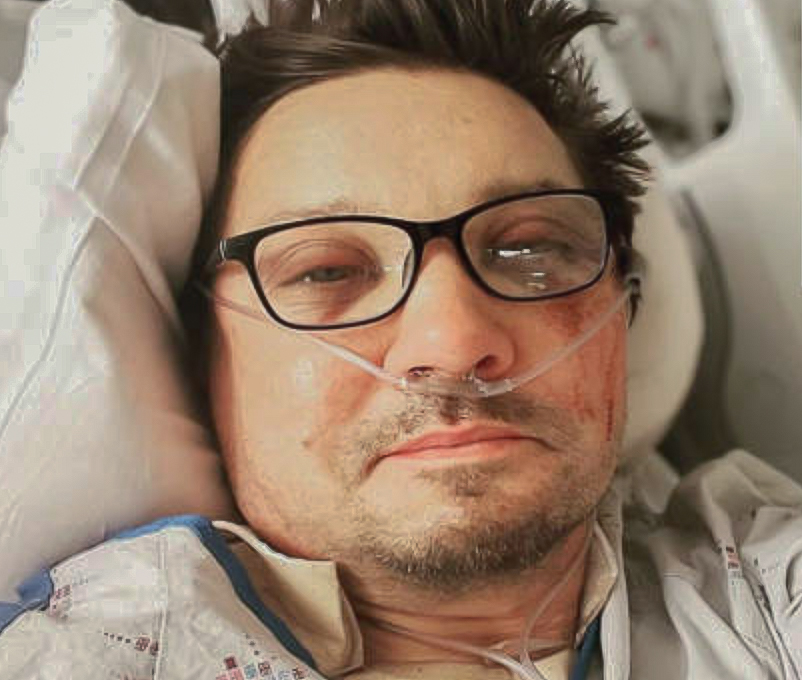 Actor Jeremy Renner recovers in a hospital after being run over by a snow plow on New Years Day.
